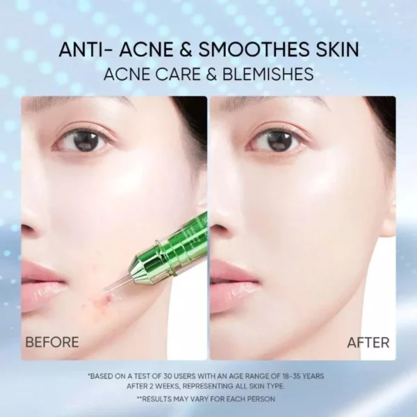 Skintific 3x Acid Intensive Acne Spot Acne Treatment Spot Gel - 11gr - Gambar 6