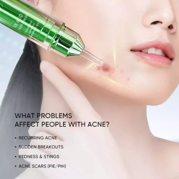 Skintific 3x Acid Intensive Acne Spot Acne Treatment Spot Gel - 11gr - Gambar 5